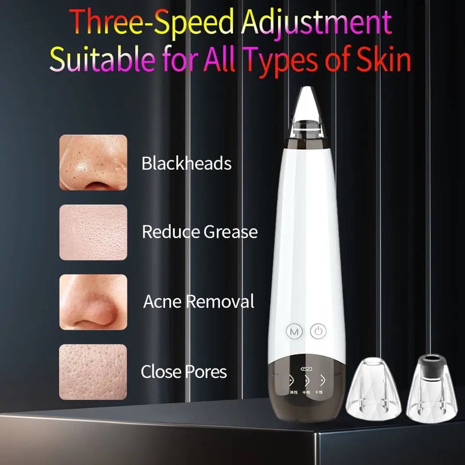 Black Spot Suction Vacuum, Blackhead Remover Cleaning Device, Electric Facial Pore Cleaner, Skincare Exfoliating Beauty Device, Facial Pore Acne Pimple Cleaner, Facial Tag Vacuum Suction, Household Professional Facial Pore Pimple Cleanser Black Spot Suction Vacuum, Blackhead Remover Cleaning Device, Electric Facial Pore Cleaner, Skincare Exfoliating Beauty Device, Facial Pore Acne Pimple Cleaner, Facial Tag Vacuum Suction, Household Professional Facial Pore Pimple Cleanser